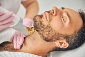 Laser Hair Removal